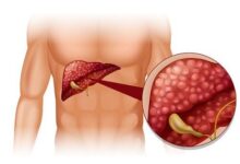 how-to-differentiate-the-pain-of-the-stomach-and-the-gallbladder?-signs-help-you-distinguish