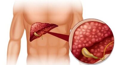 how-to-differentiate-the-pain-of-the-stomach-and-the-gallbladder?-signs-help-you-distinguish