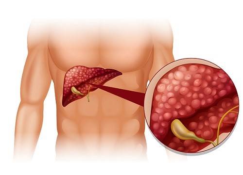 how-to-differentiate-the-pain-of-the-stomach-and-the-gallbladder?-signs-help-you-distinguish